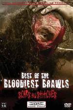 Watch TNA Wrestling: Best of the Bloodiest Brawls - Scars and Stitches Projectfreetv