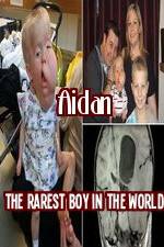 Watch Aidan The Rarest Boy In The World Projectfreetv