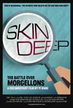 Watch Skin Deep: The Battle Over Morgellons Projectfreetv