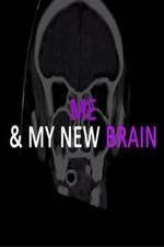 Watch Me & My New Brain Projectfreetv