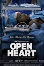 Watch Open Heart Projectfreetv