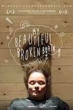 Watch My Beautiful Broken Brain Projectfreetv