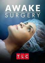 Watch Awake Surgery Projectfreetv